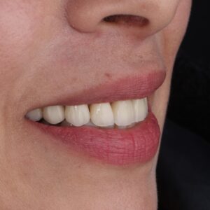 Orthodontie