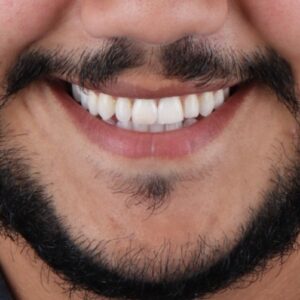 Dentisterie esthétique